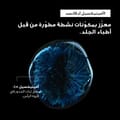 لوريال بروفيسيونيل سيروم أمينيكسيل أدفانسد ضدّ تساقط الشعر والمعزّز لقوّة الشعر للشعر الضعيف المعرّض للتساقط سيري إكسبرت 90 مل