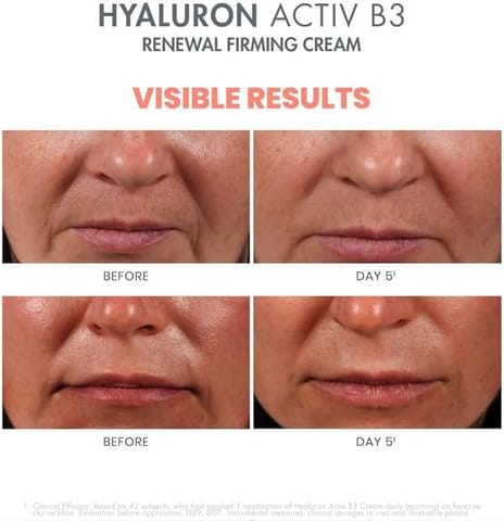 Avene Hyaluron Activ Day Cream 50Ml