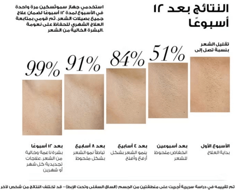 SmoothSkin Pure Fit IPL Hair Removal Device with Laser