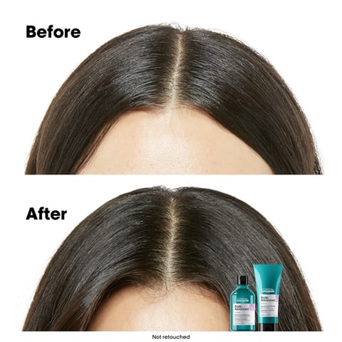 Lp Se Scalp Duo Eoy Set